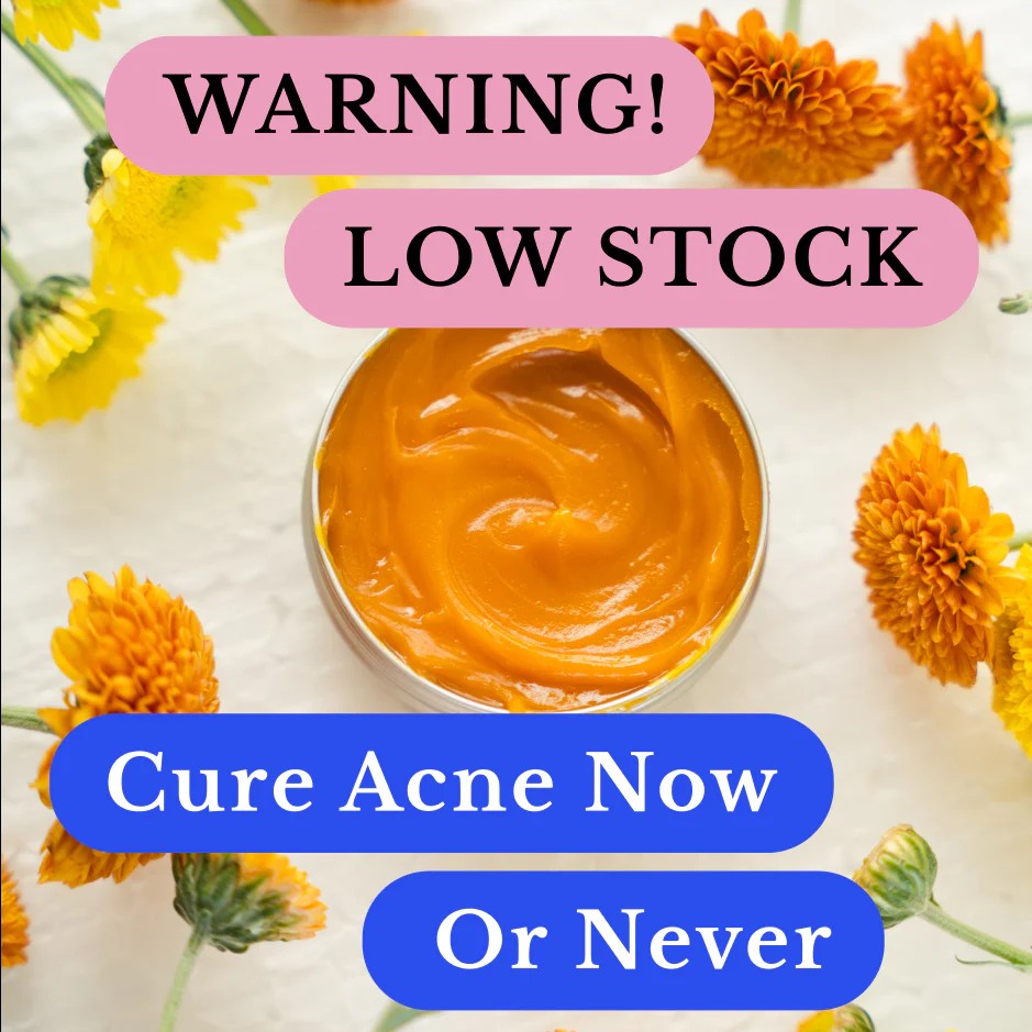 Kill Acne & Redness Ritual-Limited-Timeđ˛ Christmas Sale: 50% Offđ