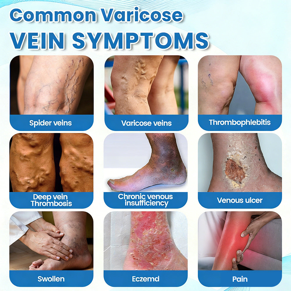 Fade Varicose & Spider Veins