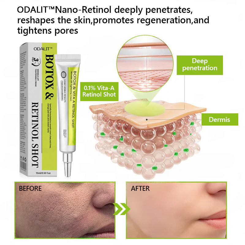 [🔥Last Day 51% OFF] ODALIT™ Botox & Retinol Shot - Eraser for Deep Wrinkles, Sagging Jowls & Puffy Eyes