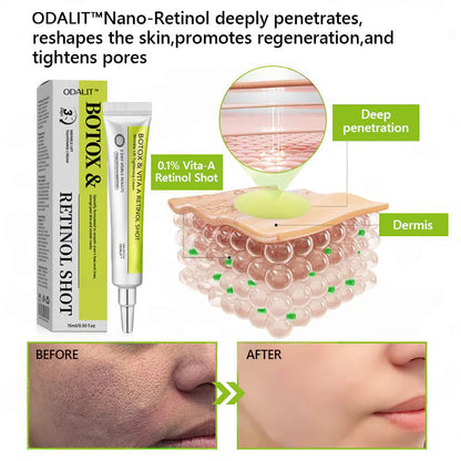 [🔥Last Day 51% OFF] ODALIT™ Botox & Retinol Shot - Eraser for Deep Wrinkles, Sagging Jowls & Puffy Eyes