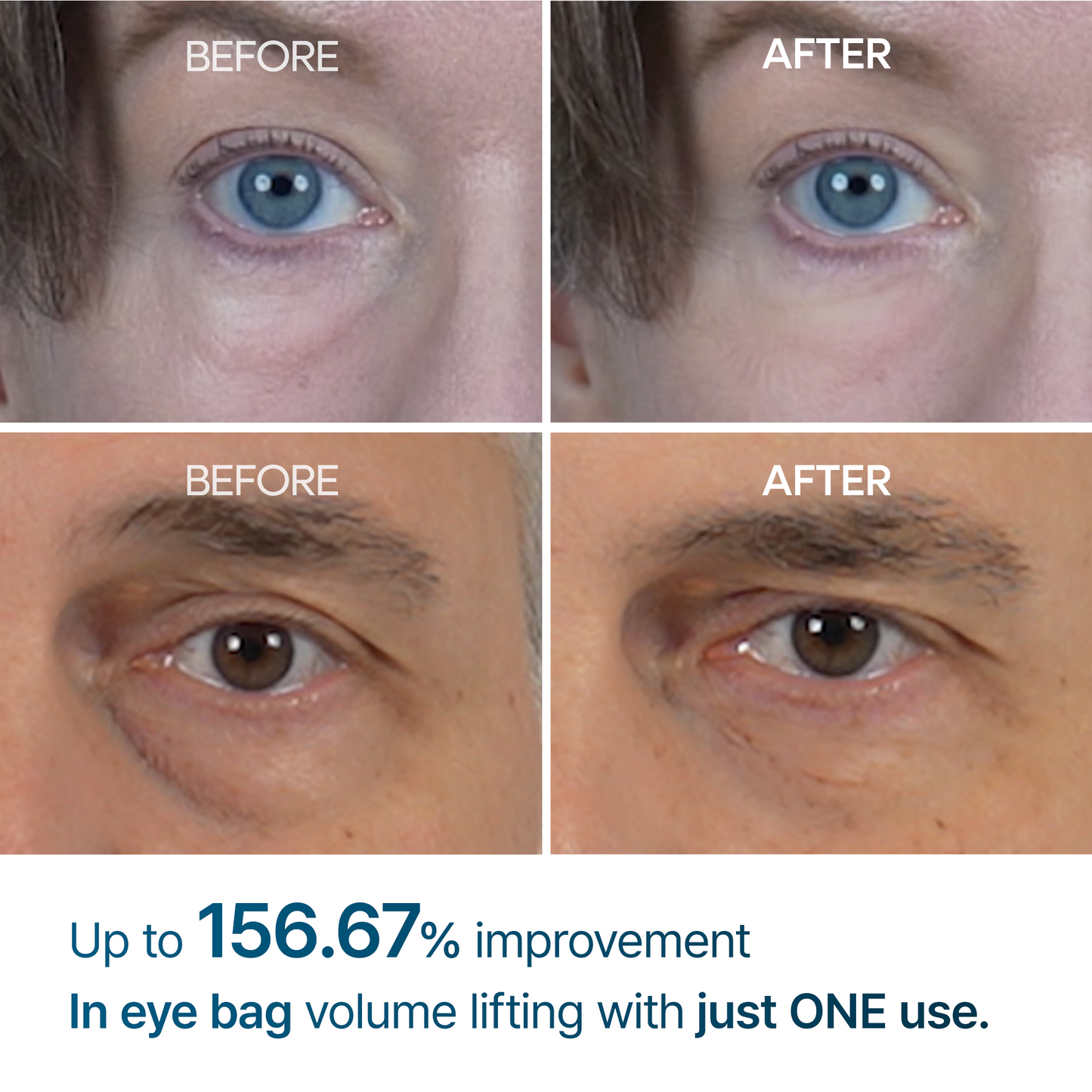👉 Seurico™ Advanced Firming Under-Eye Cream | Visibly Lifts Eye Bags & Dark Circles