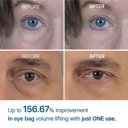 👉 Seurico™ Advanced Firming Under-Eye Cream | Visibly Lifts Eye Bags & Dark Circles