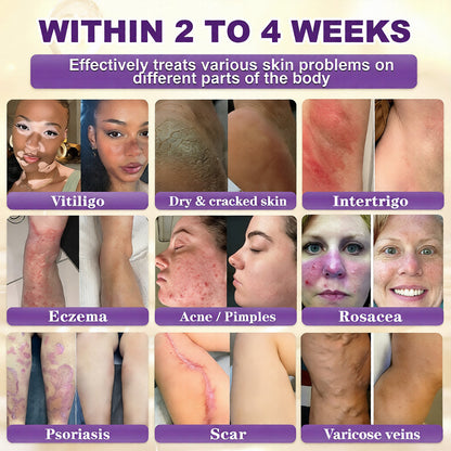 ✨ Seurico™ 10-in-1 Biotin Skin Restoration Cream | Made in USA 🇺🇸
