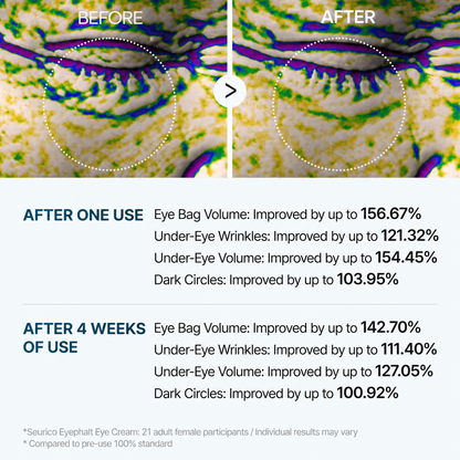 👉 Seurico™ Advanced Firming Under-Eye Cream | Visibly Lifts Eye Bags & Dark Circles