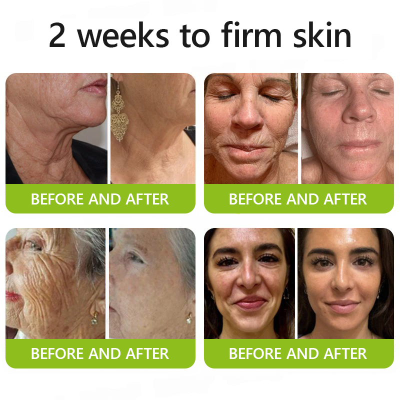 [🔥Last Day 51% OFF] ODALIT™ Botox & Retinol Shot - Eraser for Deep Wrinkles, Sagging Jowls & Puffy Eyes