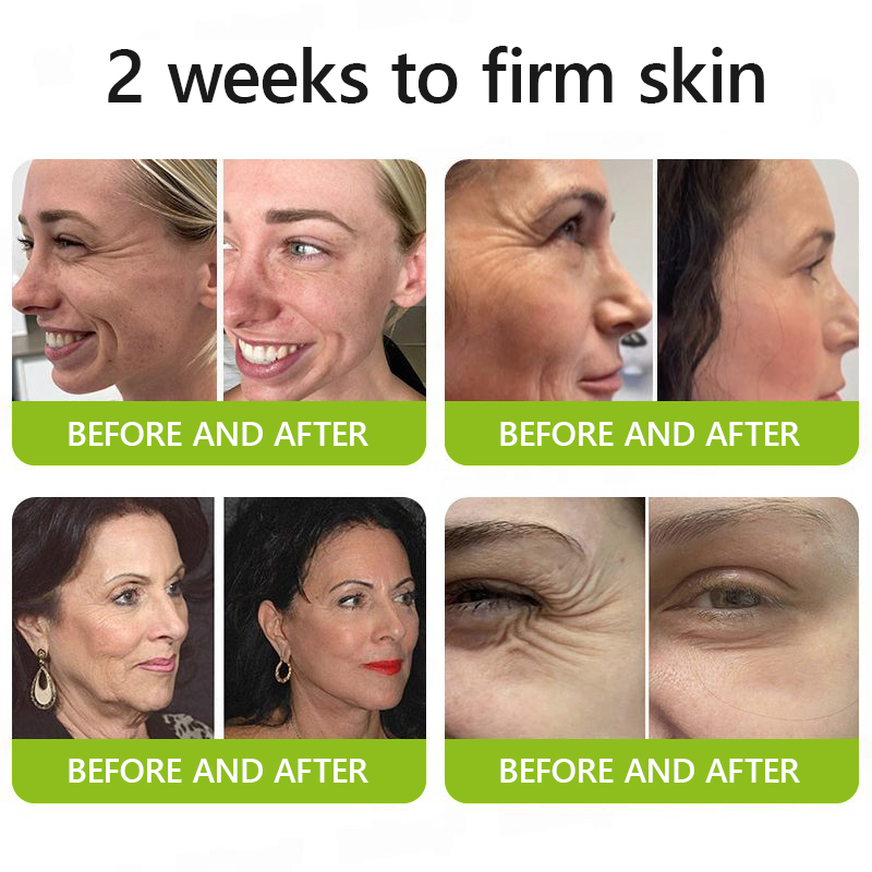 [🔥Last Day 51% OFF] ODALIT™ Botox & Retinol Shot - Eraser for Deep Wrinkles, Sagging Jowls & Puffy Eyes