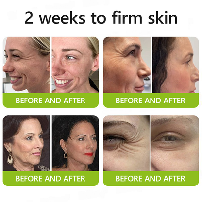 [🔥Last Day 51% OFF] ODALIT™ Botox & Retinol Shot - Eraser for Deep Wrinkles, Sagging Jowls & Puffy Eyes