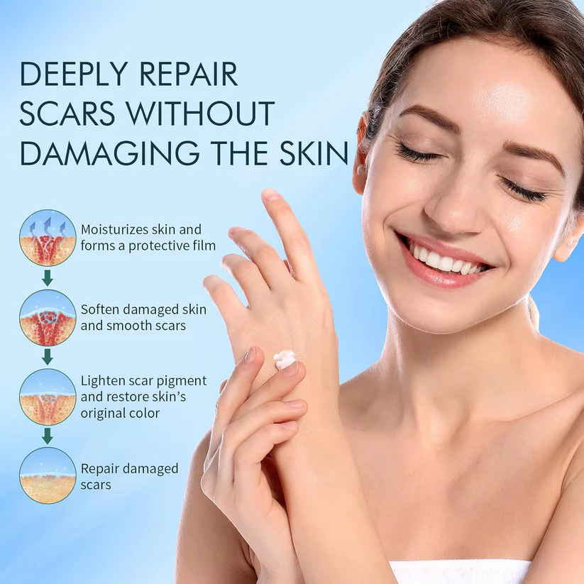 Seurico™ Scar Cream Gel, Advanced Silicone Scar Gel, Professional Scar Removal Cream for Surgical Scars, Stretch Mark, Keloid Bump, C-Section, Old and New Scars