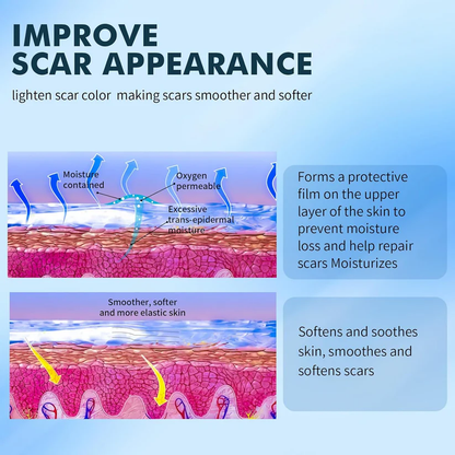 Seurico™ Scar Cream Gel, Advanced Silicone Scar Gel, Professional Scar Removal Cream for Surgical Scars, Stretch Mark, Keloid Bump, C-Section, Old and New Scars