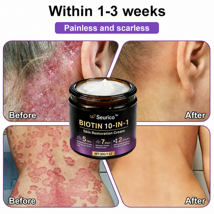 ✨ Seurico™ 10-in-1 Biotin Skin Restoration Cream | Made in USA 🇺🇸
