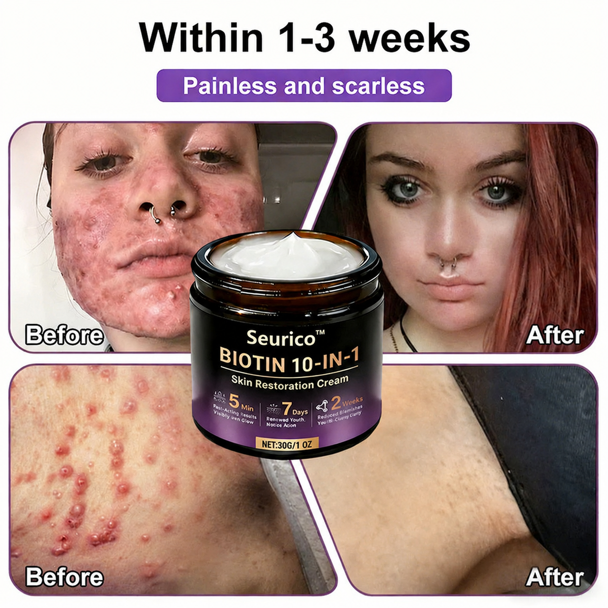 ✨ Seurico™ 10-in-1 Biotin Skin Restoration Cream | Made in USA 🇺🇸