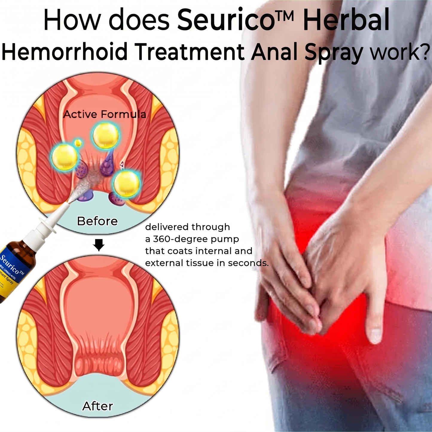 ✨ Seurico™ Touch-Free Hemorrhoid Relief Spray | Fast & Mess-Free Comfort