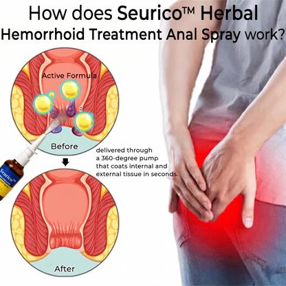 ✨ Seurico™ Touch-Free Hemorrhoid Relief Spray | Fast & Mess-Free Comfort