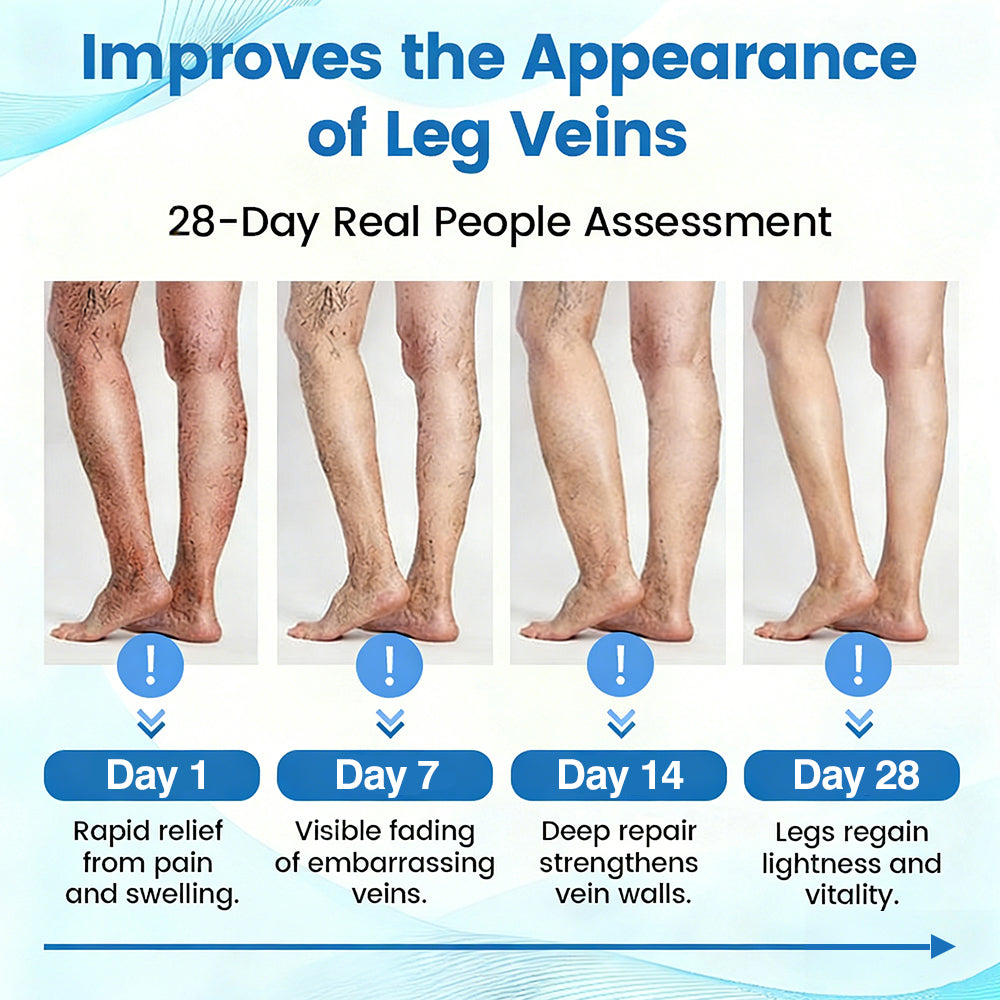 Fade Varicose & Spider Veins