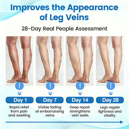 Fade Varicose & Spider Veins
