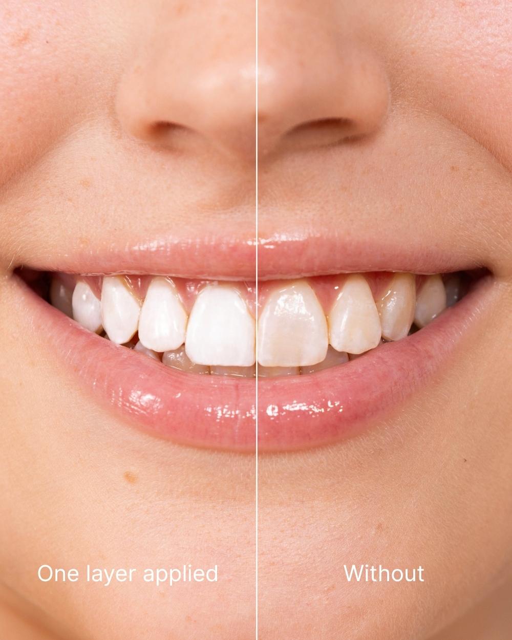 ODALIT™ Teeth Polish - Instant White Teeth-Limited Time 75%OFF Buy 1 Get 1 Free 🔥LAST DAY⏰