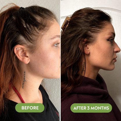 🔥Buy 2 Get 1 FREE + Free Shipping 🔥Advanced Hair Growth Serum