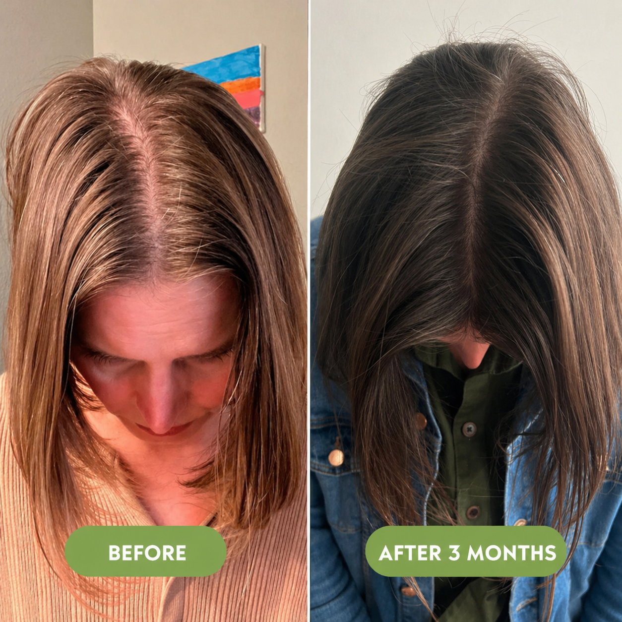 🔥Buy 2 Get 1 FREE + Free Shipping 🔥Advanced Hair Growth Serum