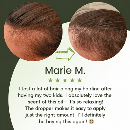 🔥Buy 2 Get 1 FREE + Free Shipping 🔥Advanced Hair Growth Serum