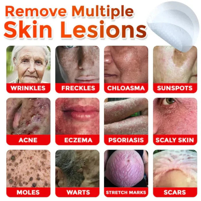 NEGUSY™ Removal Patch: Gentle Microneedle Patches for SkinTag & Mole Removal