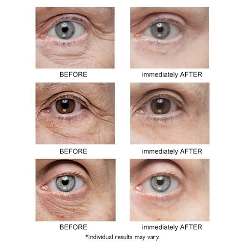 💕Instant Eye Temporary Eye Tightener💕