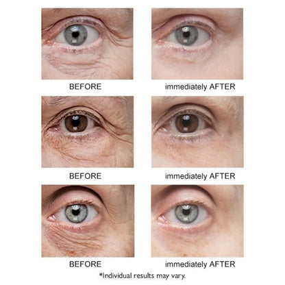 💕Instant Eye Temporary Eye Tightener💕
