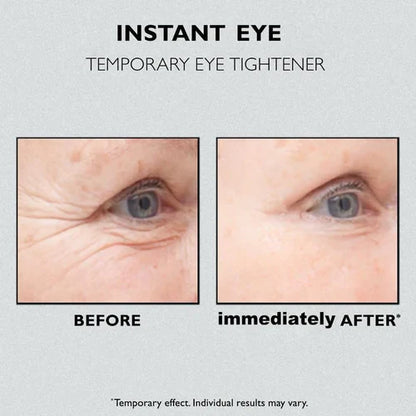 💕Instant Eye Temporary Eye Tightener💕