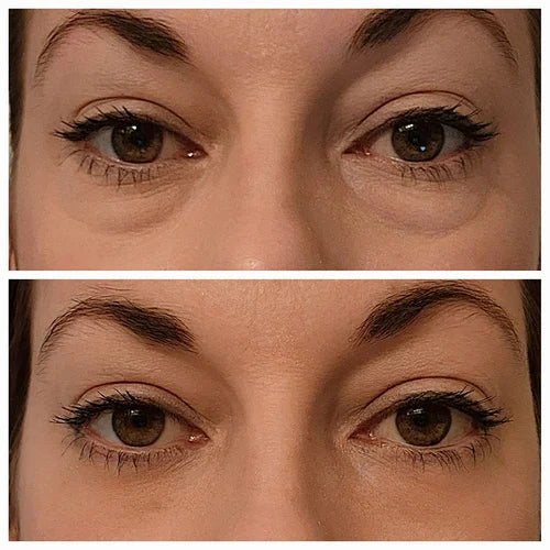 💕Instant Eye Temporary Eye Tightener💕