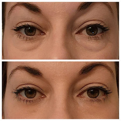 💕Instant Eye Temporary Eye Tightener💕